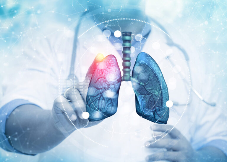 £2.61 million awarded to accelerate respiratory transformation across England